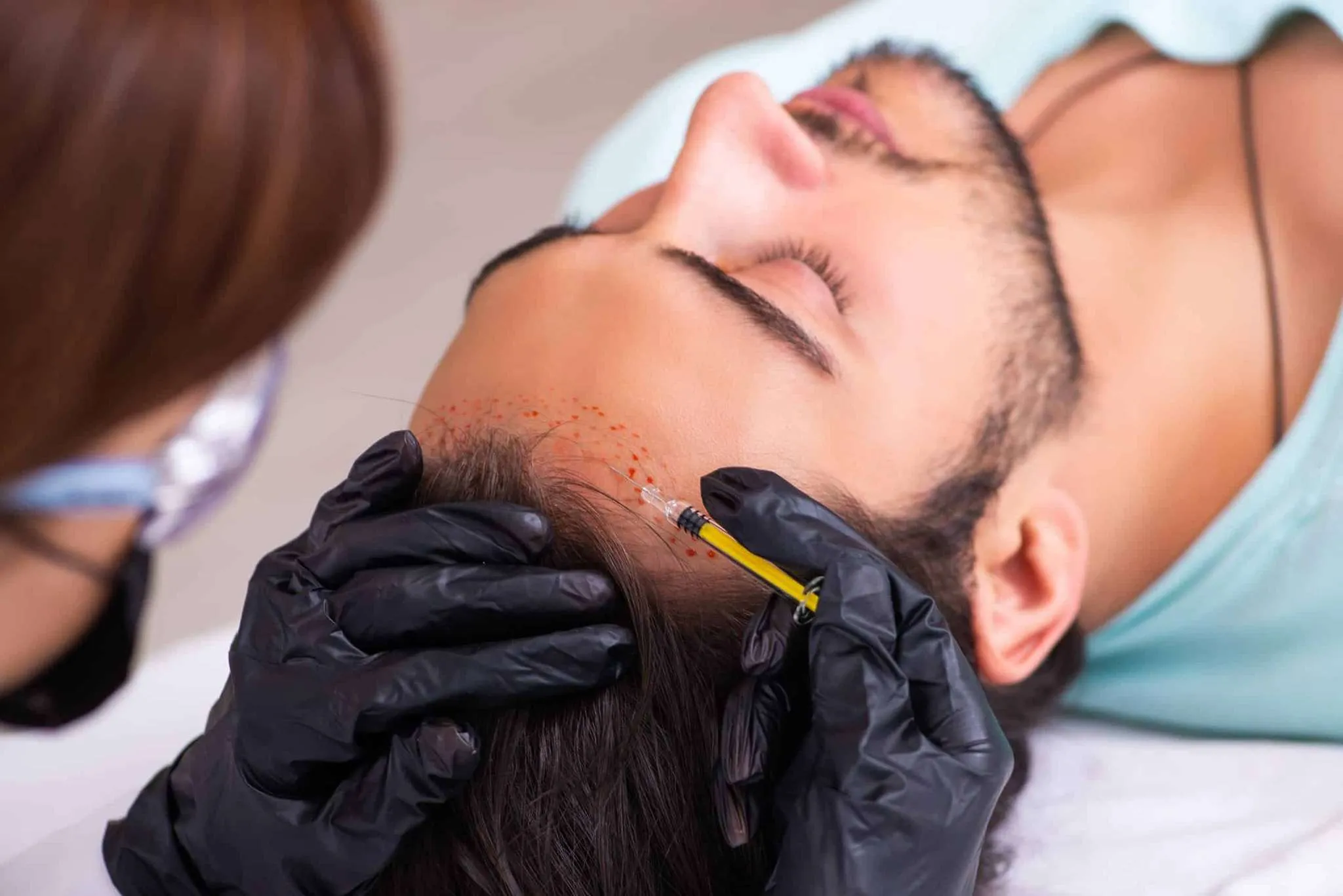 PRFM Treatment |diamond advanced aesthetics | New york