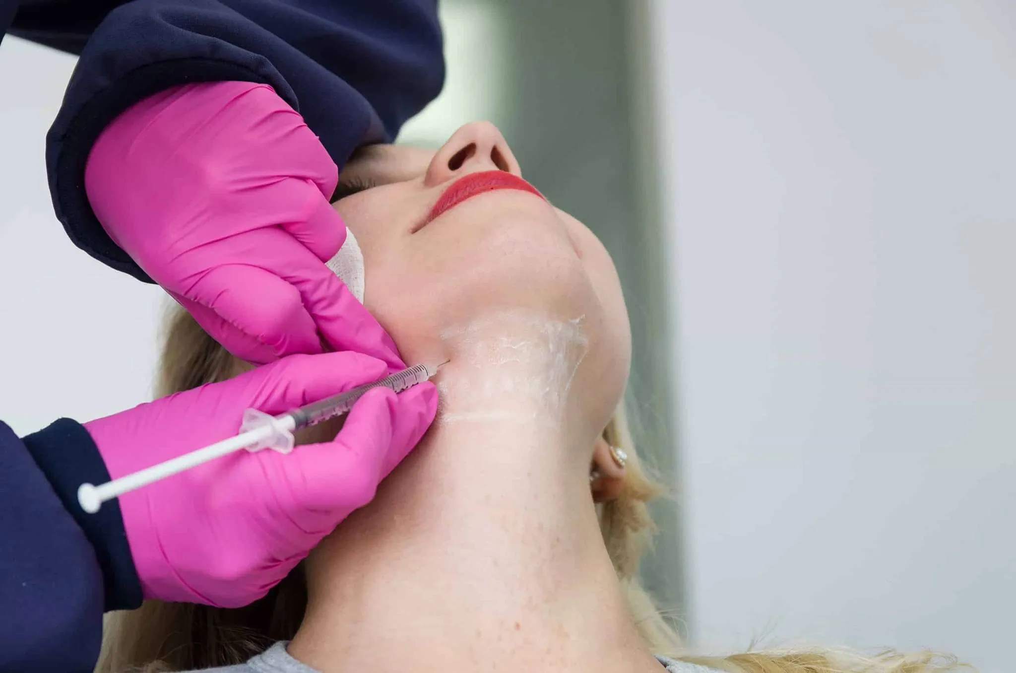 Kybella Treatment |diamond advanced aesthetics | New york