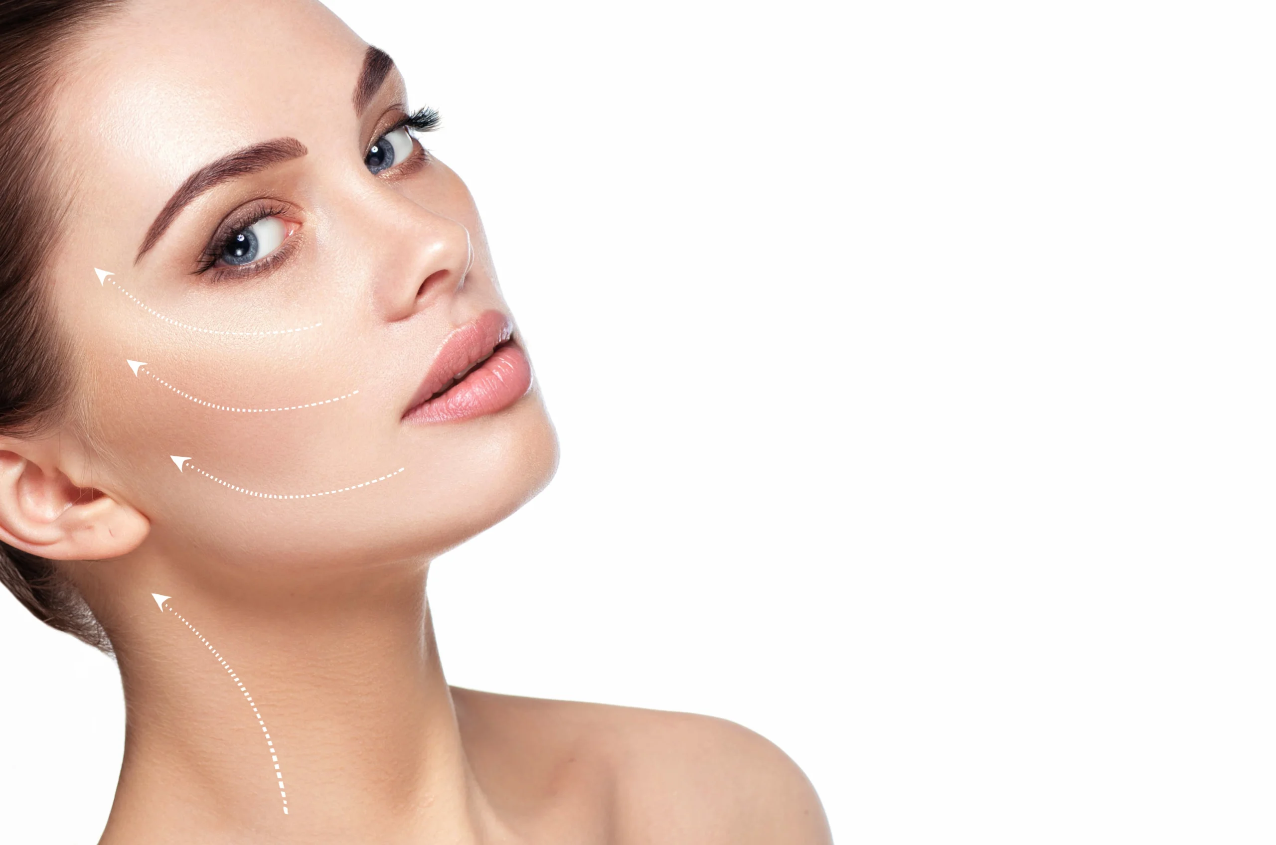 Botox injecting points shown on woman's face | Diamond Advanced Aesthetics | New York, NY