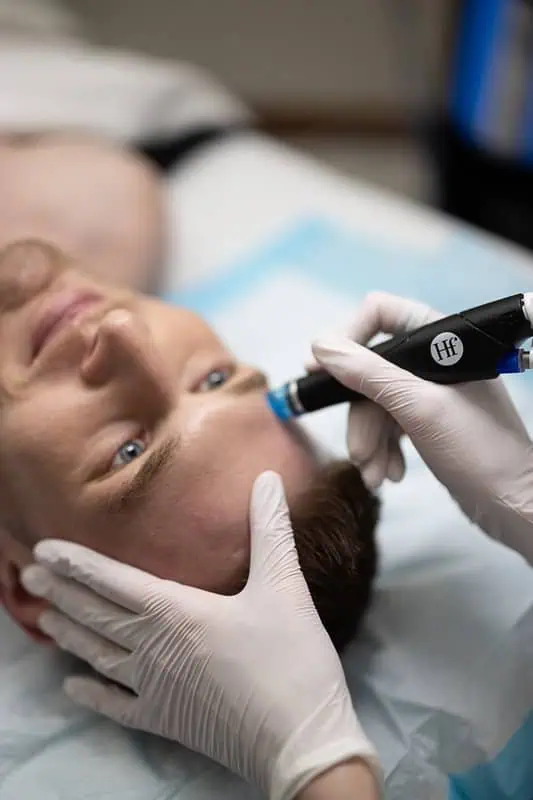 HydraFacial treatment being performed on a man's face by a licensed aesthetician