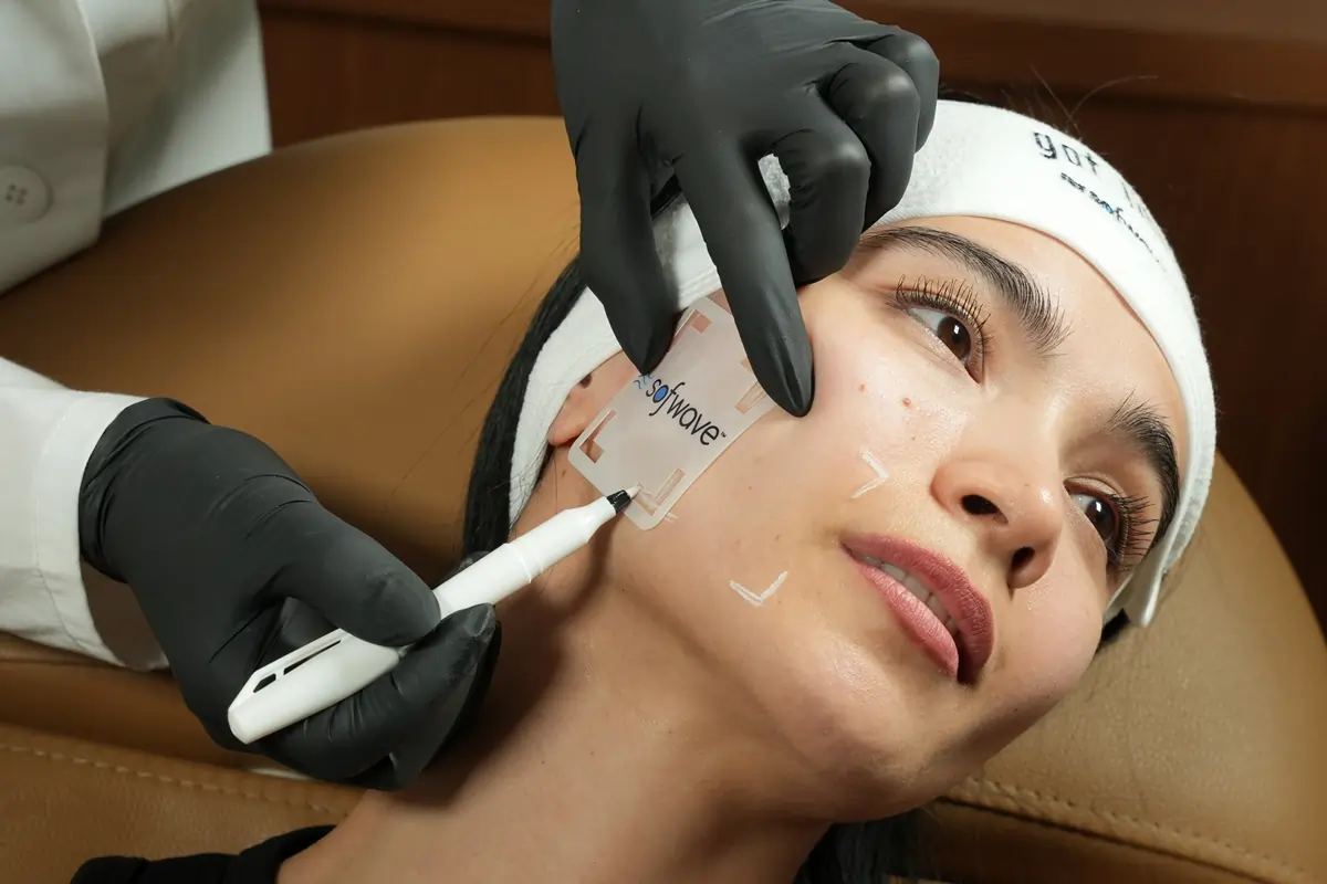 Sofwave Stimulate Collagen for Wrinkles
