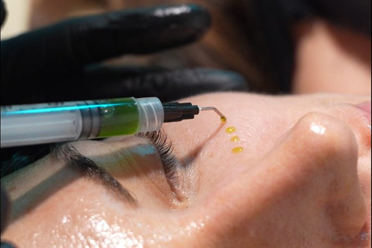 BioRePeel treatment for dark spots, acne marks, and uneven skin tone