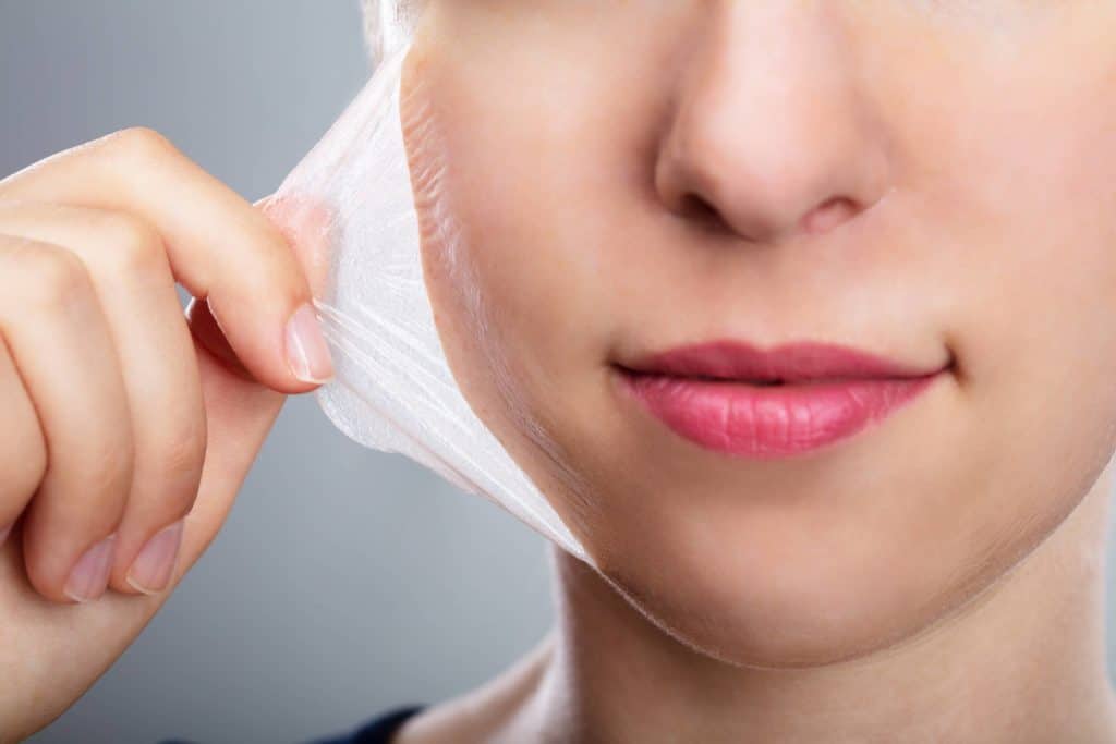 Chemical Peels New York, NY | Diamond Advanced Aesthetics